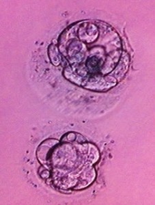 Frozen Embryos